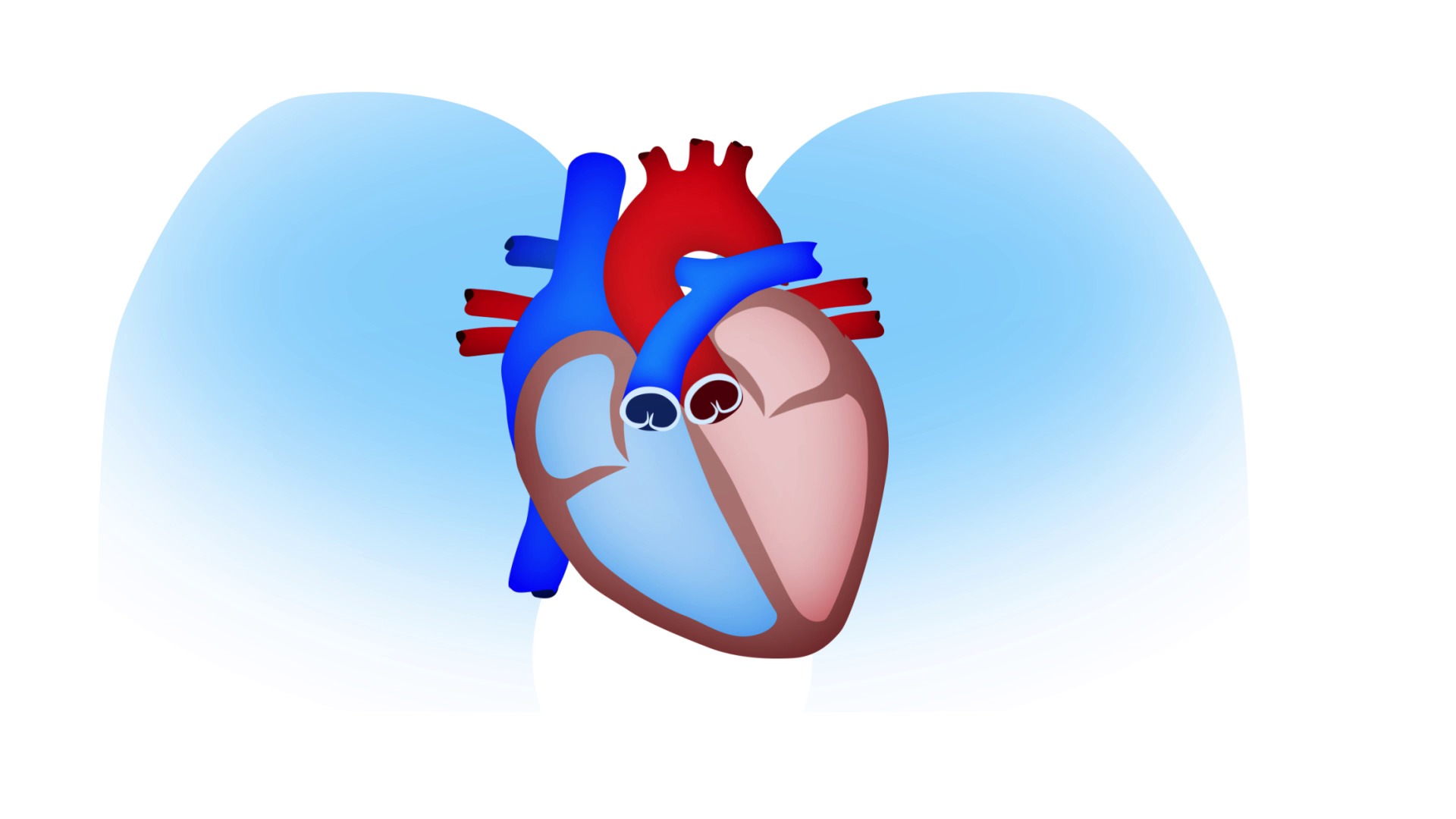 Sudden Cardiac Arrest (SCA) explained