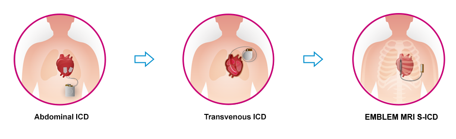 Icd Schilddr senentfernung Was Bedeuten Die ICD 10 Diagnoseschl ssel 